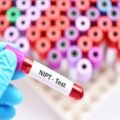 China Non-Invasive Prenatal Testing,genetic testing,Non-Invasive Prenatal Testing,nipt test,blood test,clinical test,non invasive prenatal testing,prenatal testing,china market research report,non invasive testing