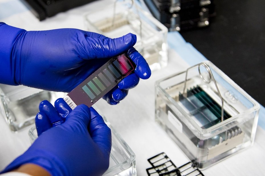 diagnostics HbA1c Testing Market,hba1c testing devices market,hba1c test labs near me,hba1c testing guidelines,why hba1c test is important