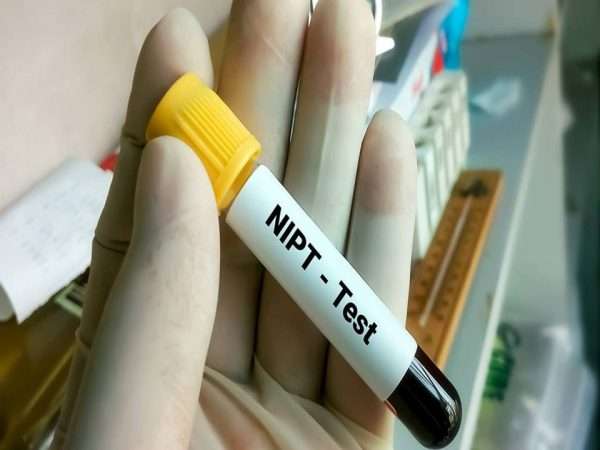 japan non invasive prenatal testing